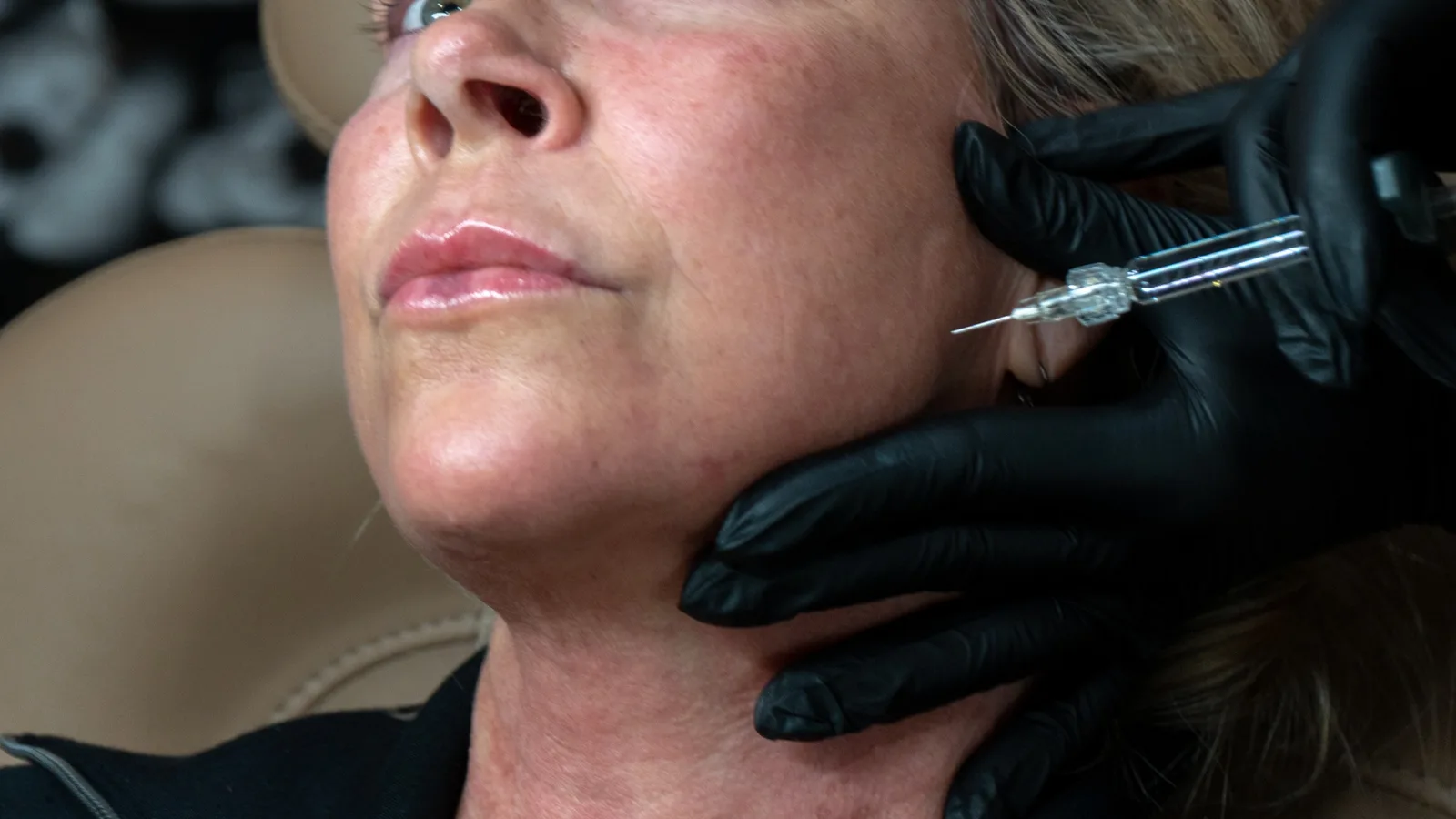 Client receiving treatment